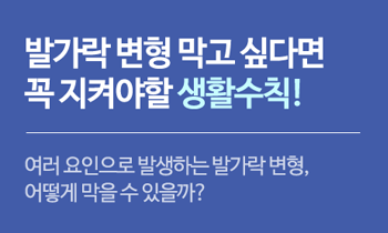 여러 요인으로 발생하는 발가락 변형, 어떻게 막을 수 있을까?