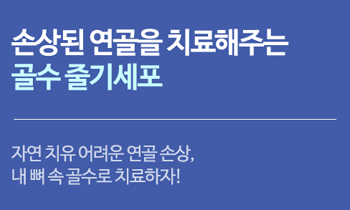 [골수 줄기세포] 손상된 연골을 치료해주는 골수 줄기세포