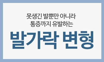 굽어지고 휘어지는 발가락 변형, 예방수칙으로 지켜내세요!