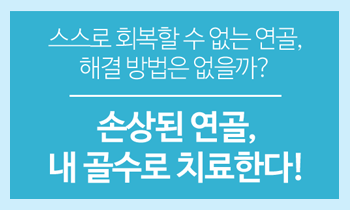 [골수 줄기세포] 스스로 회복할 수 없는 연골, 해결 방법은?