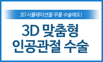 강남 연세사랑병원과 함께 3D 시뮬레이션을 이용한 인공관절 수술을 알아보세요!
