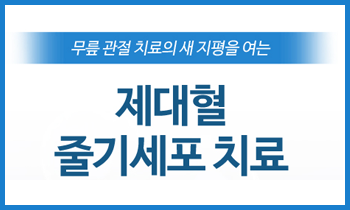 [제대혈 줄기세포] 초·중기 무릎 퇴행성관절염 치료를 위한 제대혈 줄기세포