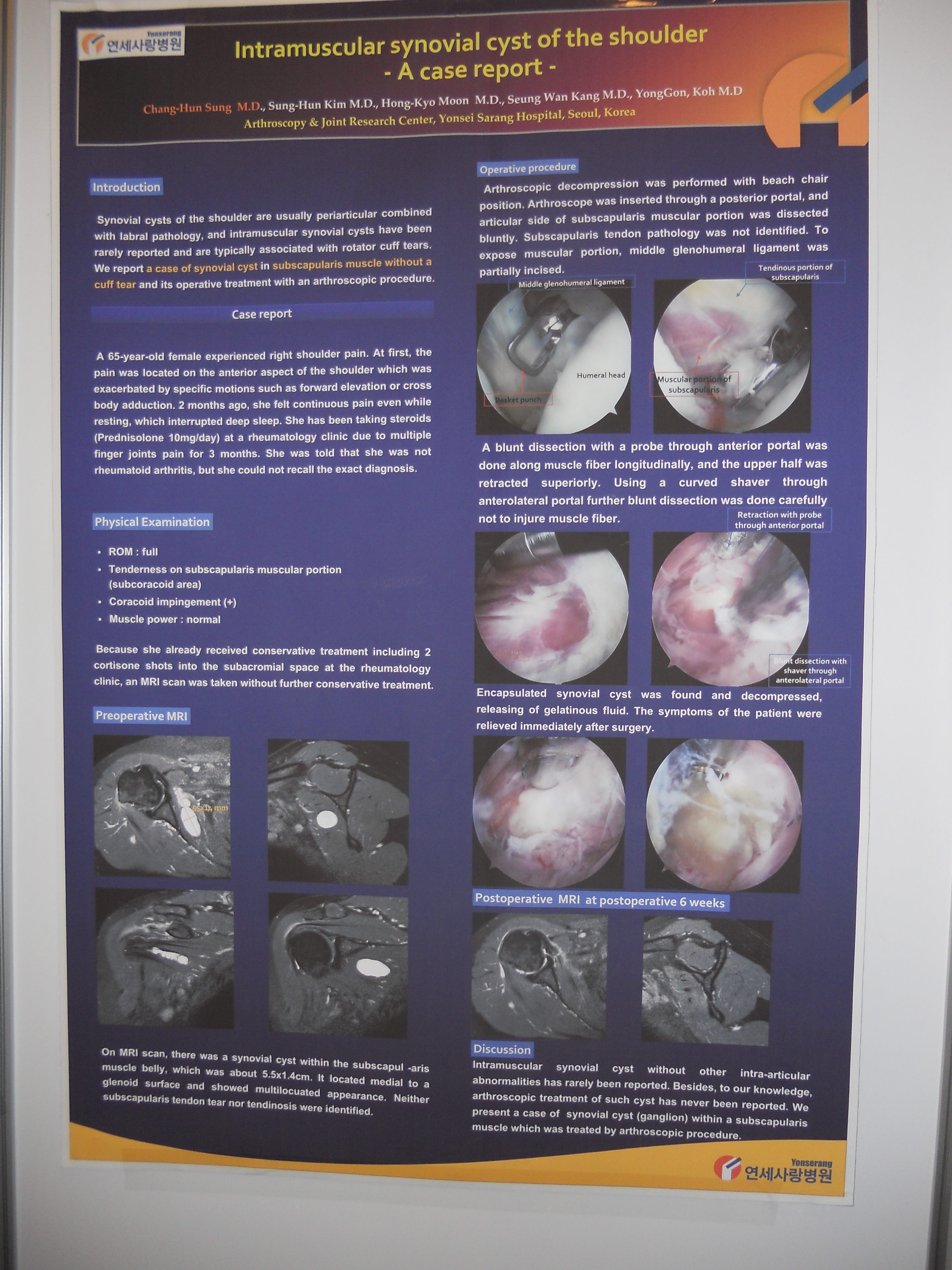 [2010 대한정형외과학회 포스터부문] 회전근 근육 내에 생긴 활막 낭종 게시글의 1번째 첨부파일입니다.