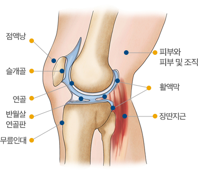 무릎측면