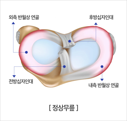 정상무릎